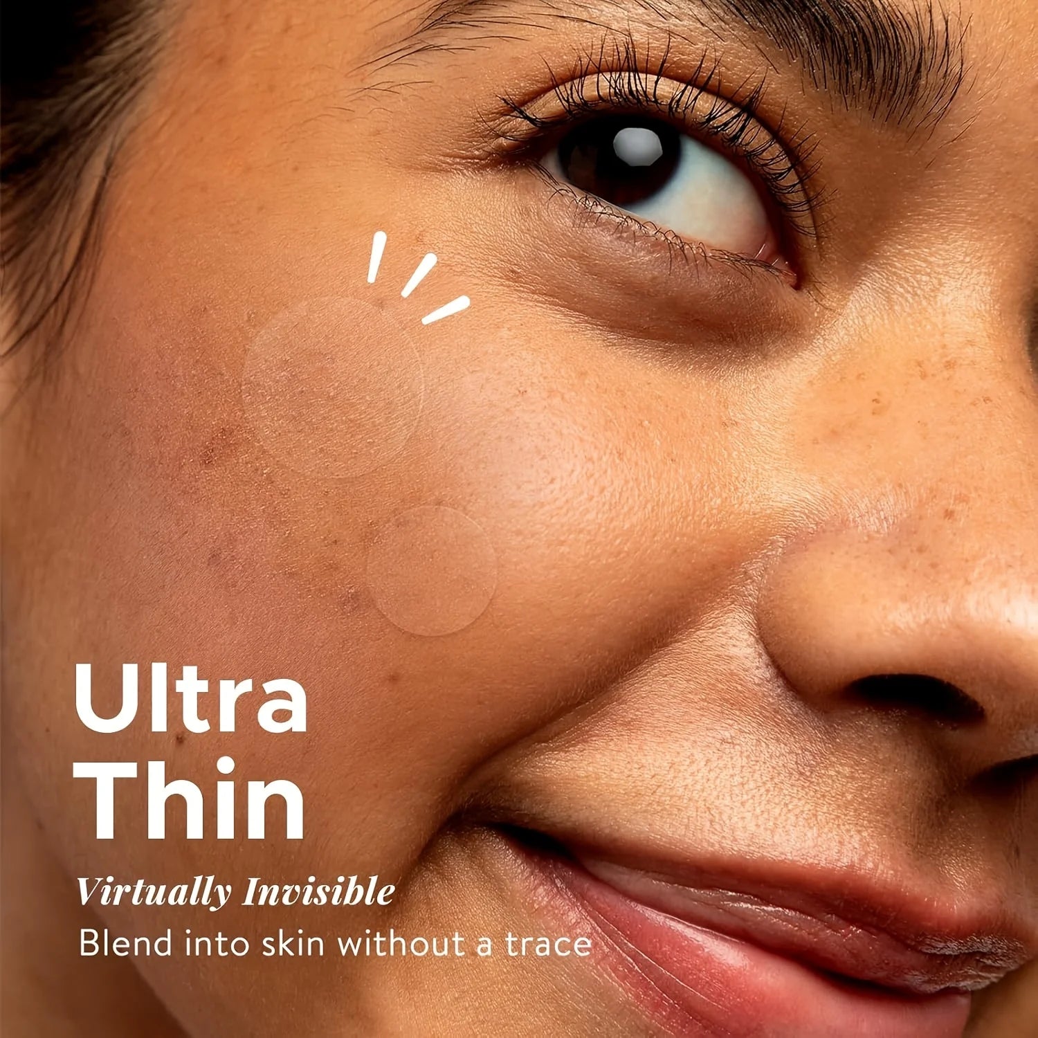 360Count Acne Patch, Covers Pimple And Acne, Acne Pimple Patch for Covering Zits And Blemishes, Spot Stickers for Face And Skin - Shiny Leaf